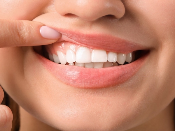 5 Steps to Improve Your Gum Health